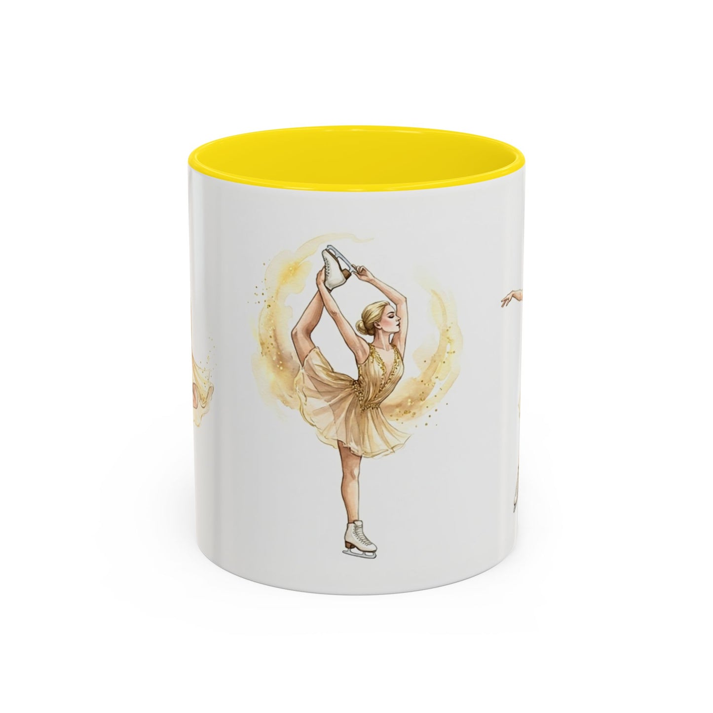 [MetDream Exclusive] "Golden Champion" Premium Two-Tone Accent Mug